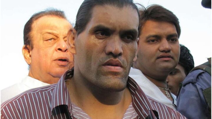 11 Famous People With Acromegaly & Gigantism