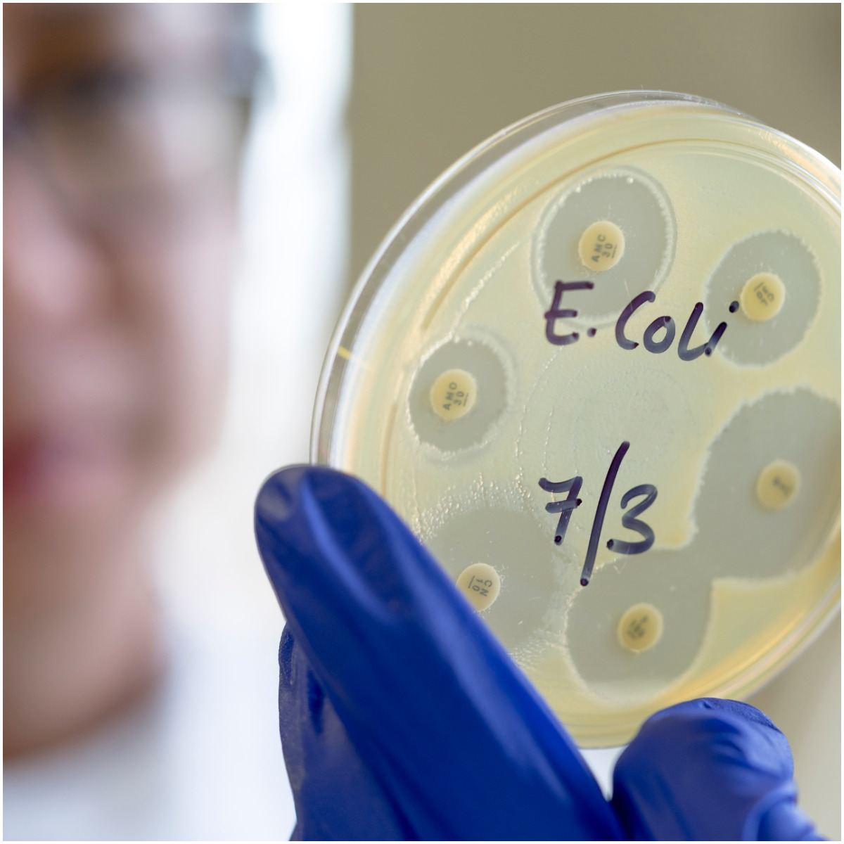 Facts About E. Coli SYMPTOMS
