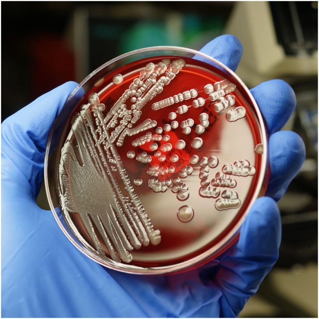 experiments on e.coli