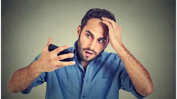 Telogen Effluvium vs Male Pattern Baldness (MPB) – Differences