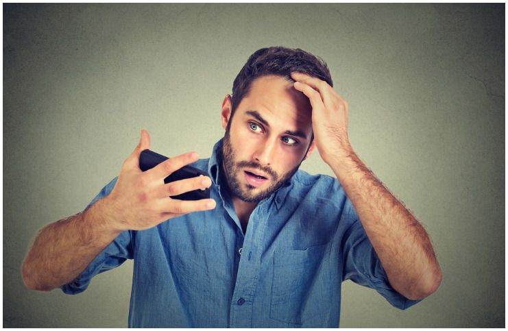 Telogen Effluvium vs Male Pattern Baldness Health Guide Net