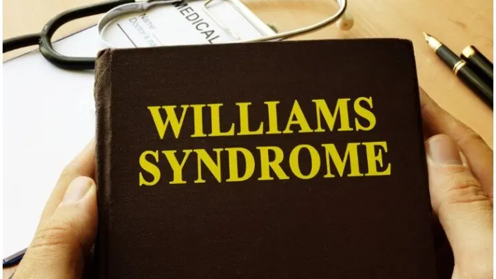 16 Interesting Facts About Williams Syndrome & Symptoms + Causes