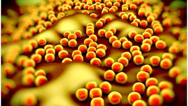 28 Interesting Facts About Staphylococcus Aureus Infection