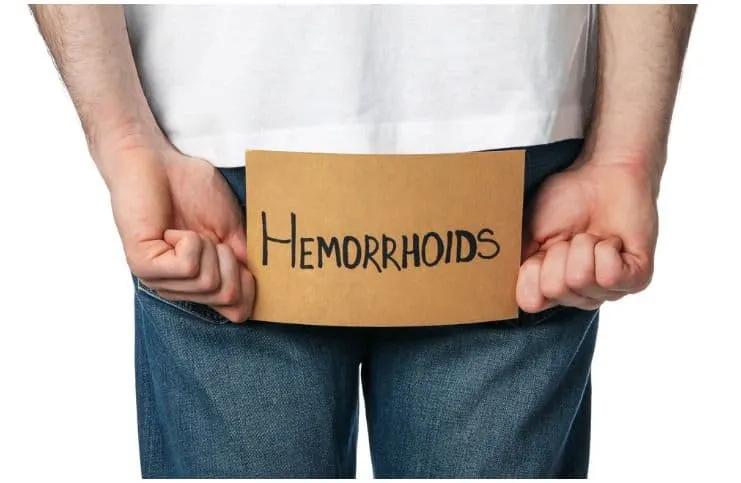 Hemorrhoids