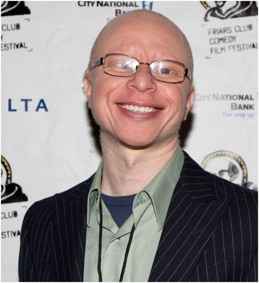 Famous People with Albinism - Health Guide Net